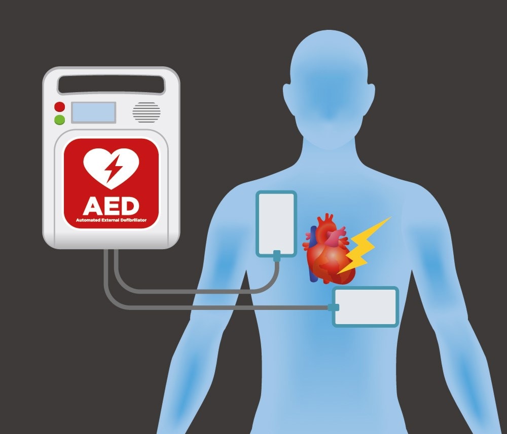 aed-defibrilatory-pomahaju-zachranit-zivot